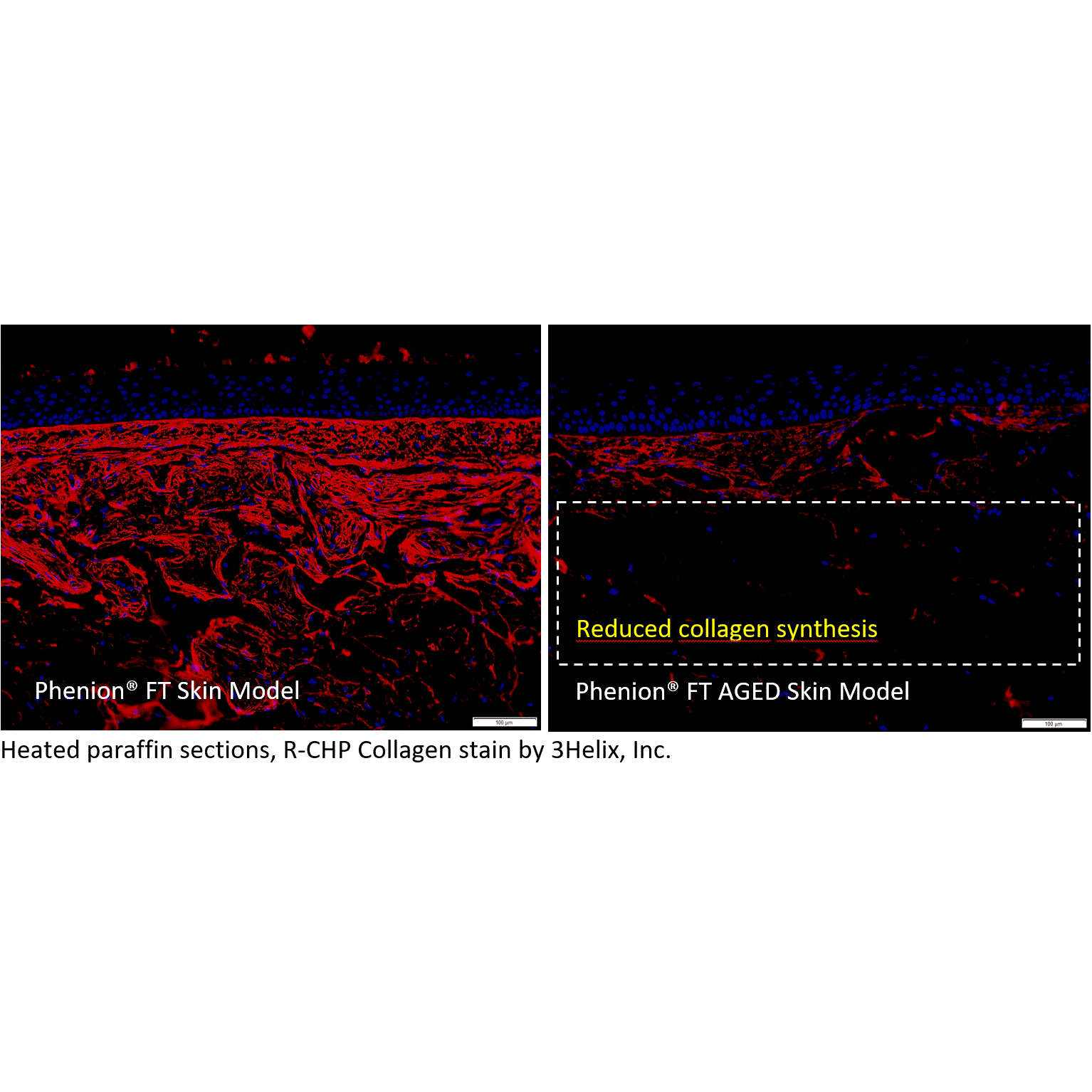 Collagen_illustration_PheFT_Standard_vs_AGED(2)
