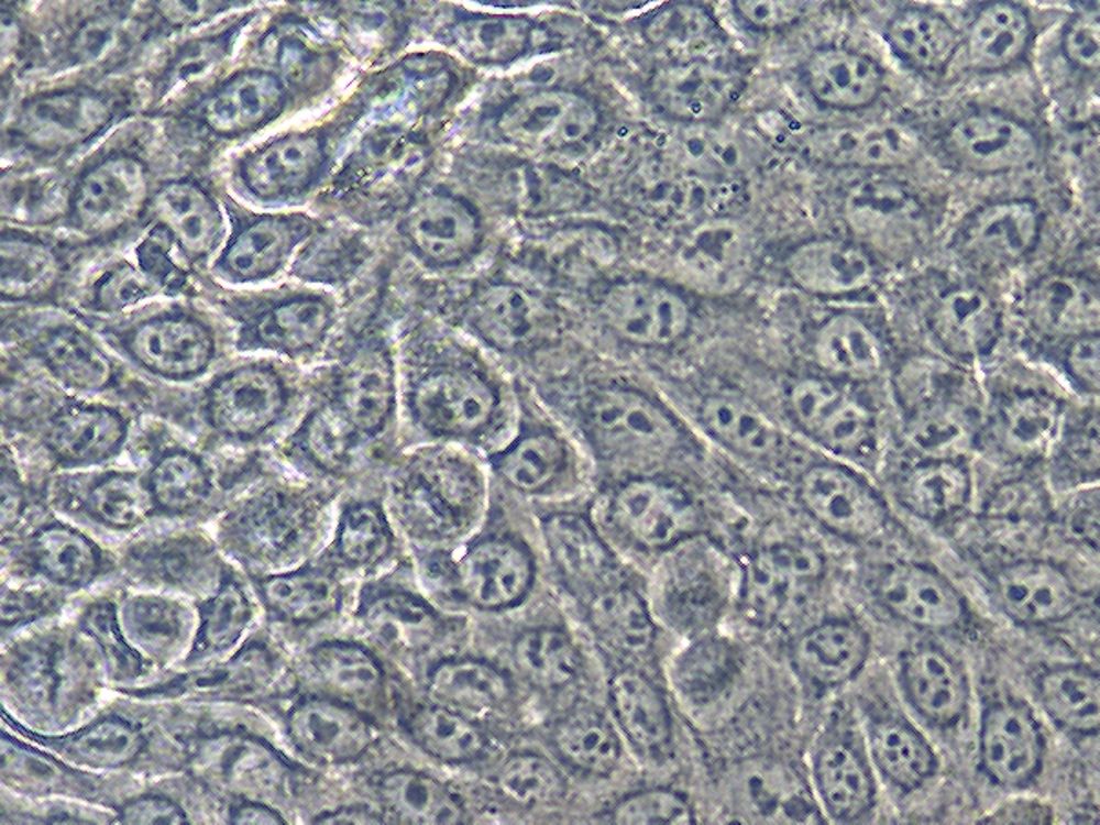 Primary Human Skin Cells