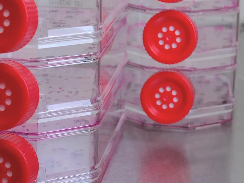 Human primary cell culture for Phenion skin model