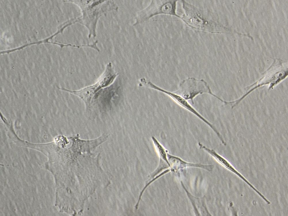Primary Human Skin Cells